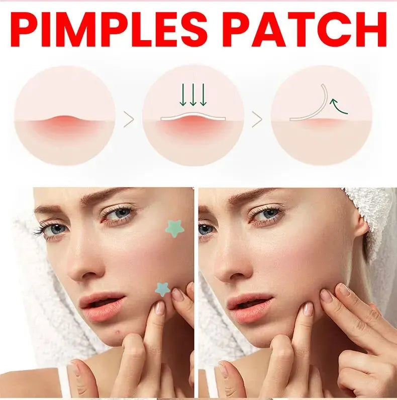 Acne Repair Patches