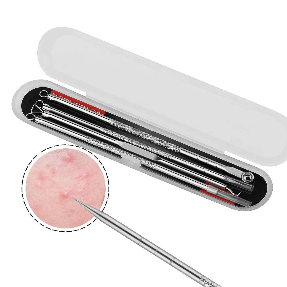 Blackhead Acne Remover 4 Piece Set